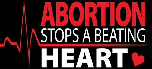 Abortion Stops A Beating Heart